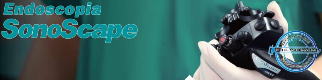 Equipos de endoscopia Sonoscape - nuevos
