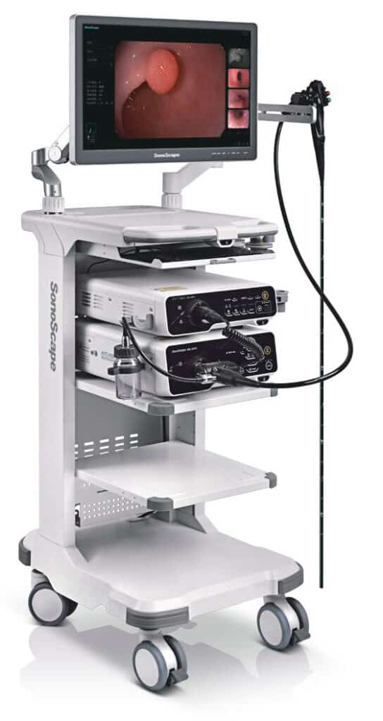 Equipos de Endoscopia Sonoscape - nuevos